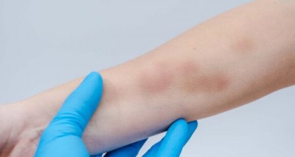 Médecins : forte hausse des violences signalées