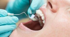 Chirurgiens-dentistes : une plate-forme dédiée à l’emploi dans les cabinets libéraux